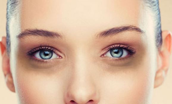 How-to-get-rid-of-dark-circles-under-eyes-fast-overnight
