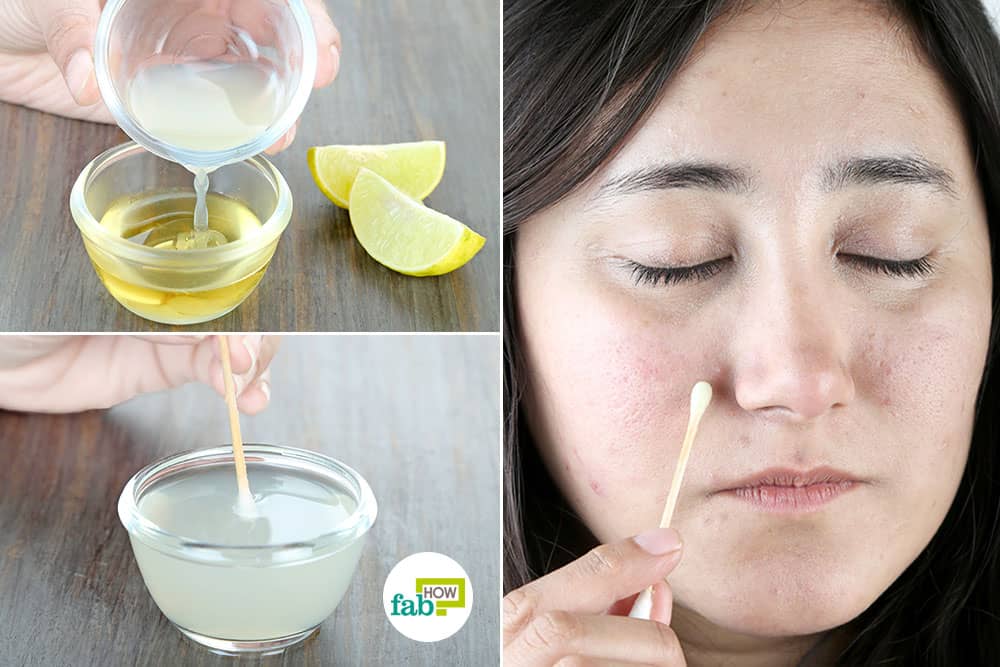 How to remove black spots on face using lemon juice